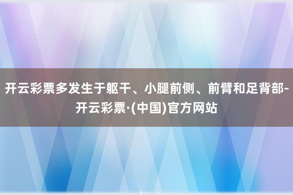 开云彩票多发生于躯干、小腿前侧、前臂和足背部-开云彩票·(中国)官方网站